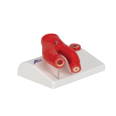 3B Scientific 2-Part Atherosclerosis Model with Artery Cross-Section